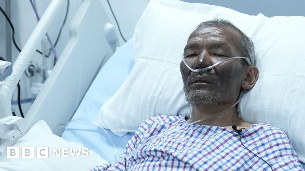 Эверест жетекшісінің керемет аман қалуы туризм индустриясына сұрақтар туғызады