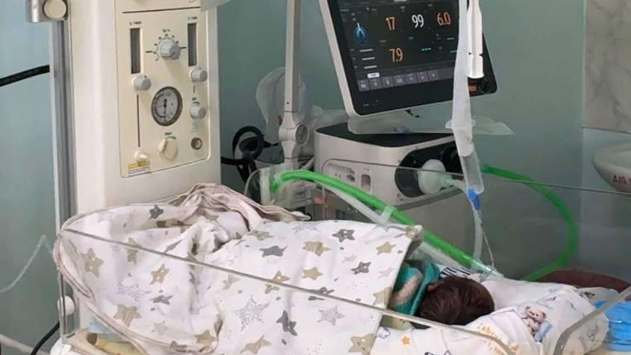 Алматинские врачи удалили беременной женщине 5-килограммовую опухоль вместе с ребенком