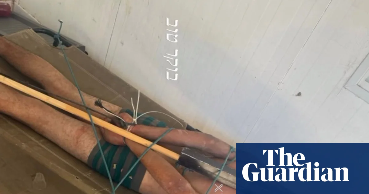 Photo of bound Palestinian detainee corroborates Israeli torture reports