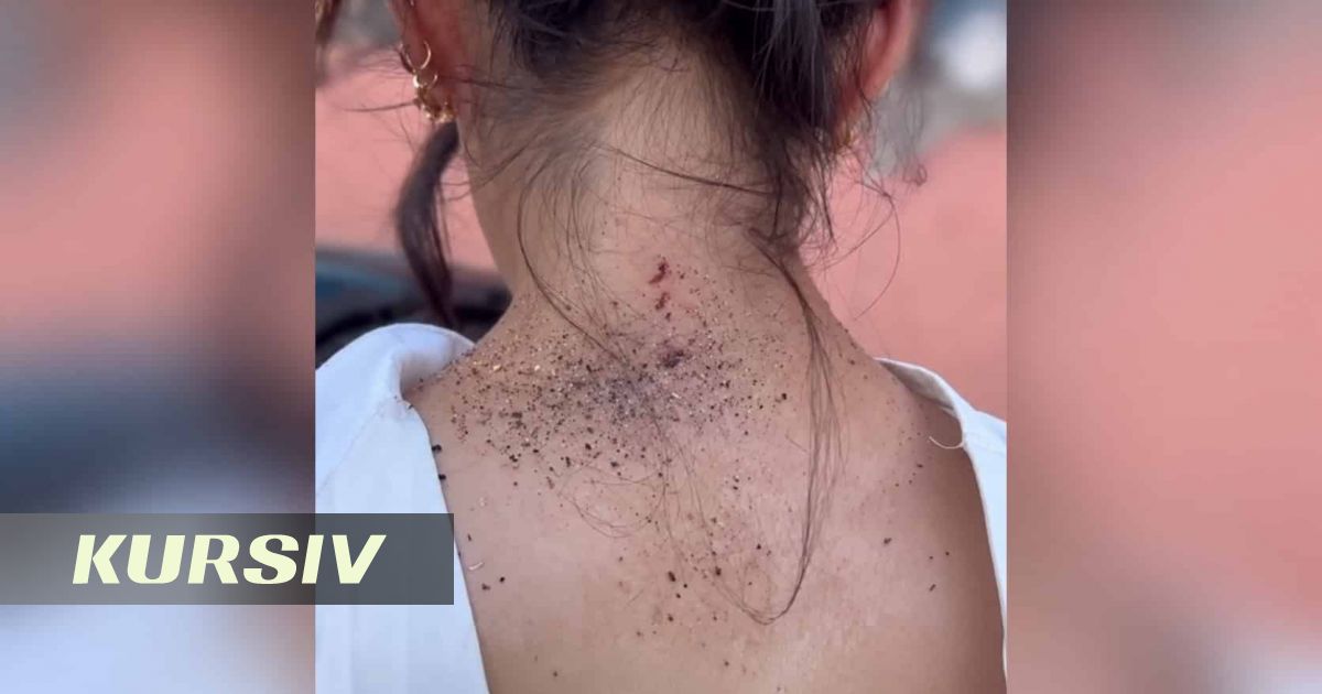Pensioner attacks Karaganda woman with bottles and scissors over dress